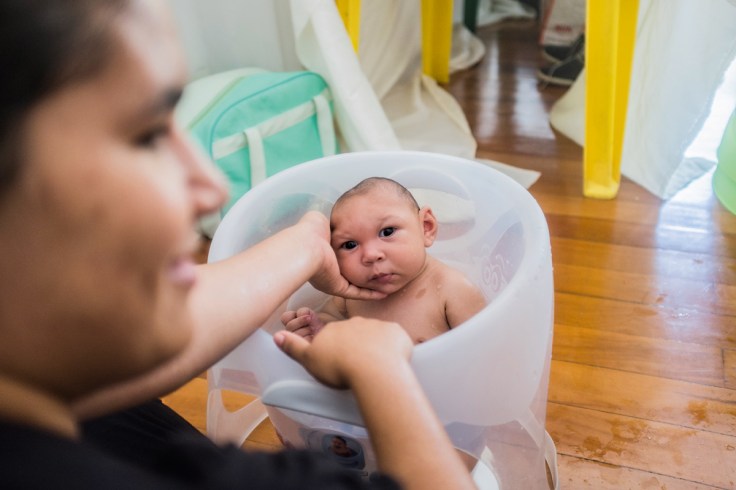 1_pl521_microcefalia1