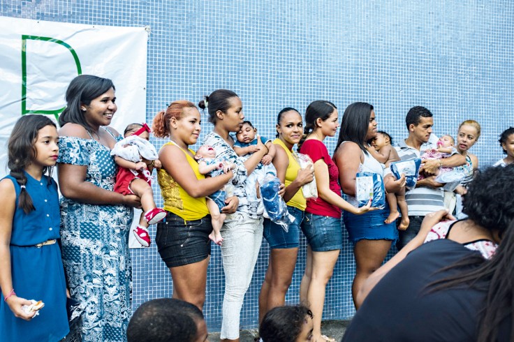 1_pl521_microcefalia8